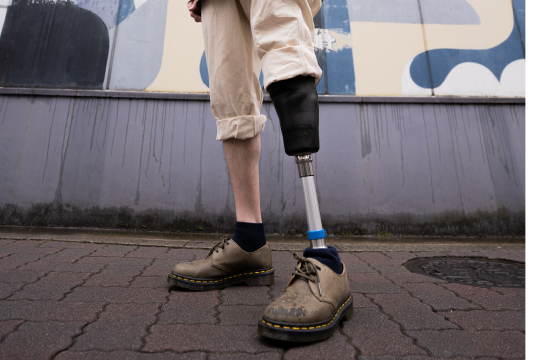 Why 3D Printing is the future of prosthetics?