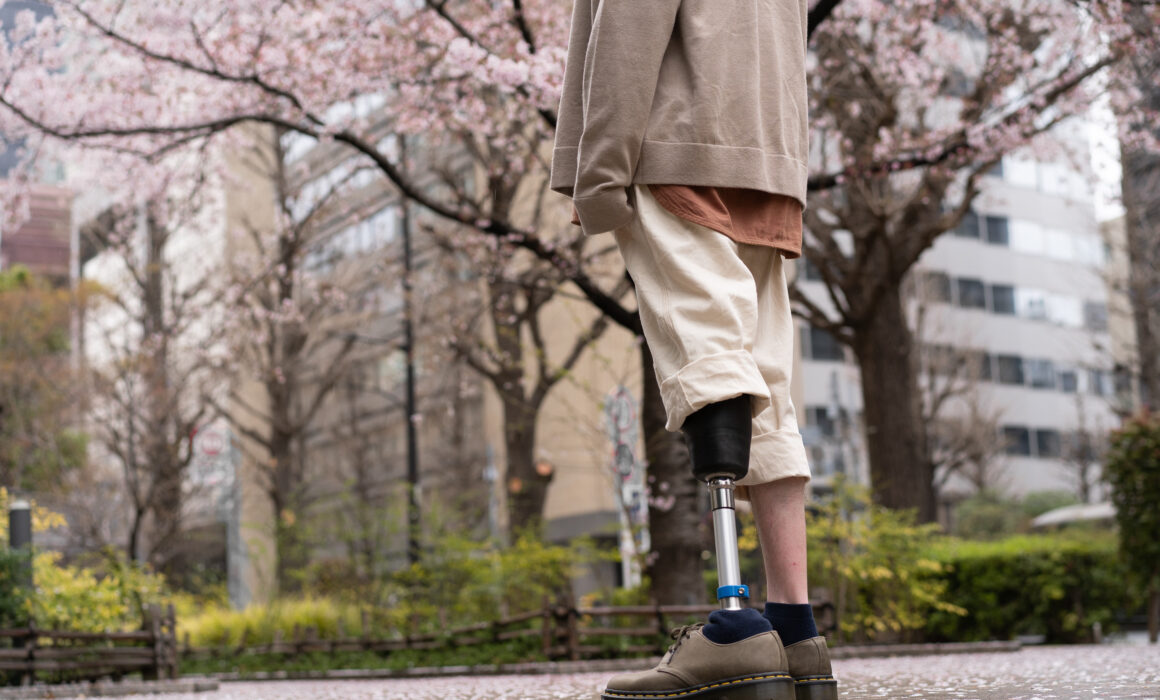 Uncovering the Myths About Artificial Legs